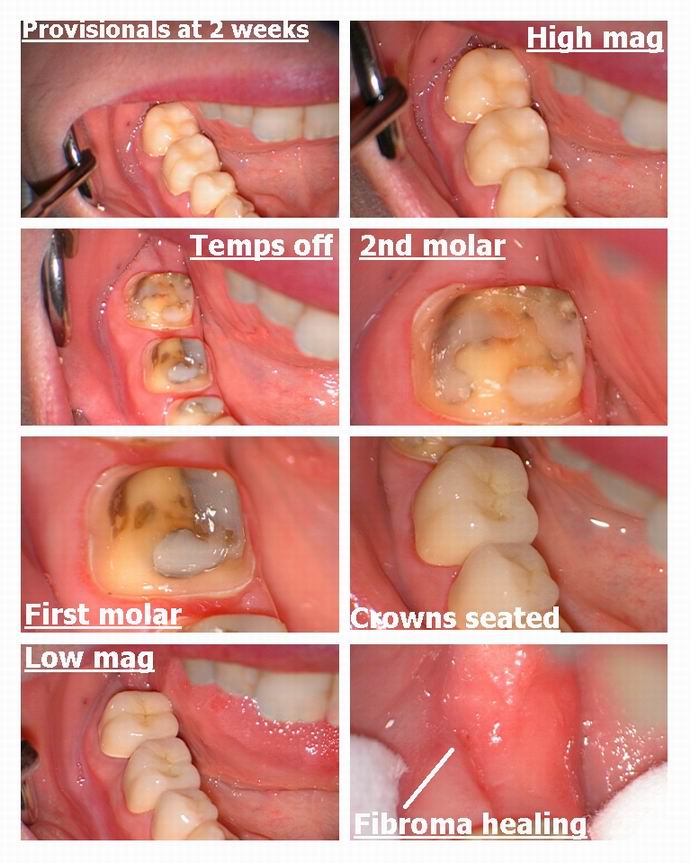 Resize of Preps pg 3.jpg